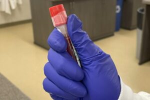 An MTN Laboratory team member holds a vial with a blood sample.
